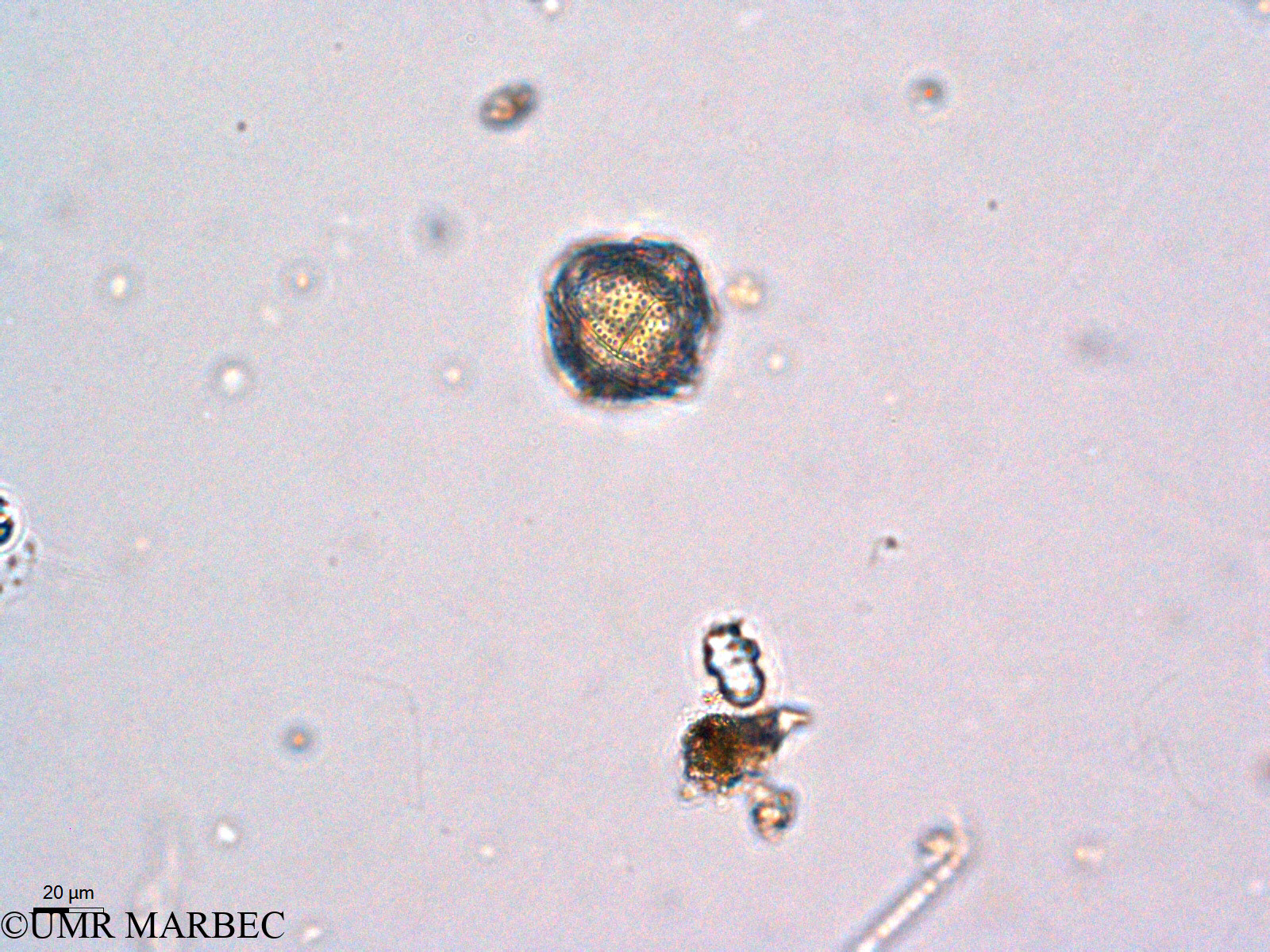 phyto/Thau_Lagoon/THAU_station1/GELAMED 2010/Lingulodinium polyedrum (ancien Protoceratium reticulatum syn. Gonyaulax grindleyi -3)(copy).jpg